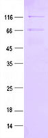 Purified recombinant protein ADAR (K744R) was analyzed by SDS-PAGE gel and Coomossie Blue Staining.